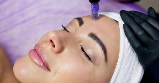 HYALURON PEN kezelés, Beauty Bar Kozmetika Veresegyház, Vincze Gabriella kozmetikus